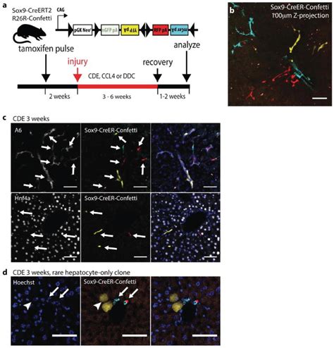 Clonal tracing of Sox9+ liver progenitors in mouse oval cell injury ... 