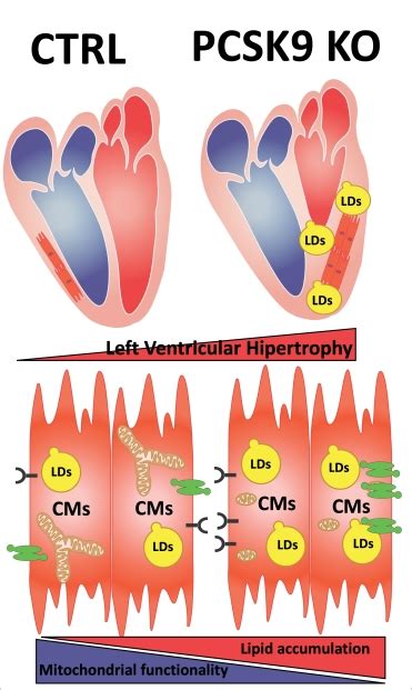 Pcsk9 Deficiency Rewires Heart Metabolism And Drives Heart Failure With