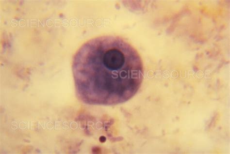 Entamoeba Histolytica Lm Stock Image Science Source Images