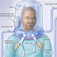 Effect of Helmet Noninvasive Ventilation vs. High-Flow Nasal Oxygen in Patients with COVID-19 ...