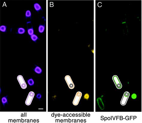 Evidence That Subcellular Localization Of A Bacterial Membrane Protein