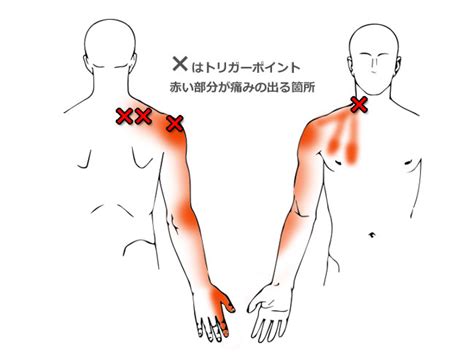 四十肩・五十肩・腕の痛み 【阿佐ヶ谷の整体】土日、祝日も営業！マッサージ師も通う大川カイロプラクティックセンターあさがや整体院【阿佐ヶ谷の