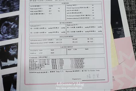 【產檢紀錄】懷孕初期0 3個月 0w～12w 王家瑋婦產科and禾馨民權產檢項目及懷孕初期的營養補充品 倩兒☓魯蛋 夢享生活