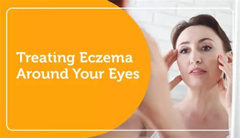 Treating Eczema Around Your Eyes | MyEczemaTeam