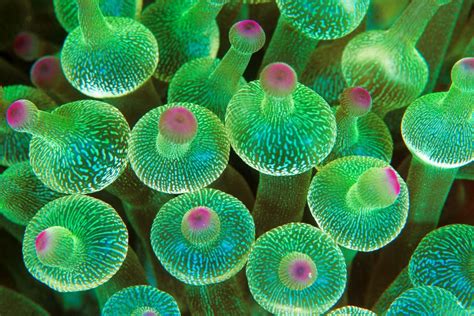 DYRK1A, related kinases & human disease conference 