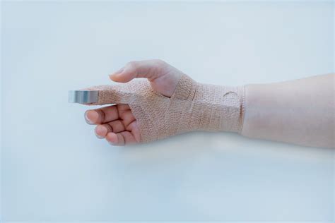 Understanding Finger Dislocation: Causes, Symptoms, Treatment, and the Role of Physiotherapy ...