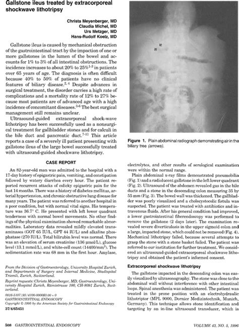 Gallstone Ileus Treated By Extracorporeal Shockwave Lithotripsy