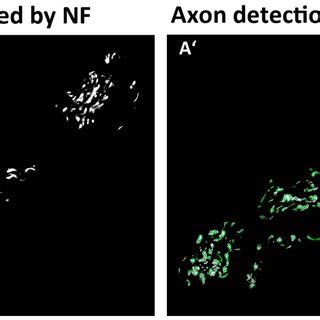 Neurofilament staining of region of interest (ROI) I and II (scale ...