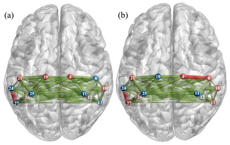 Brain Sciences Free Full Text Using Functional Connectivity To