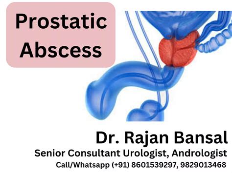 Best Urologist In Jaipur India Urology Hospital Near Me