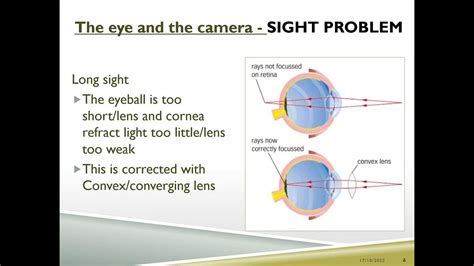 Ks3 Eyes And Vision Lesson Function Of Parts Of Eye And Eye Problems