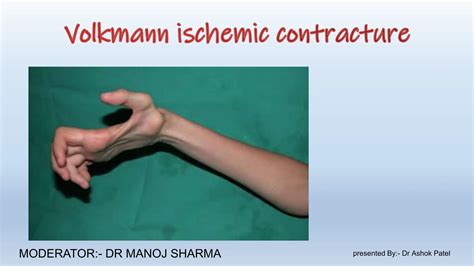 Volkmann Ischemic Contracture Orthopaedics Pptx