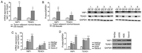 Yap And Tead Are Highly Expressed In Osteosarcoma Tissues And Cells