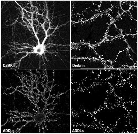 Upper: Neurons and more precisely dendritic spines were visualized on a ... 