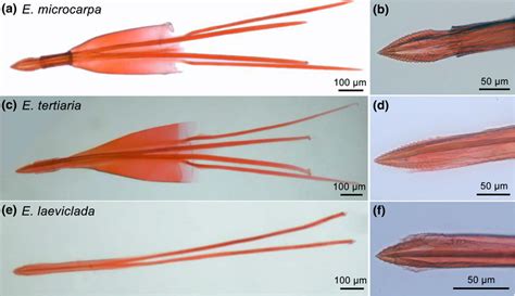 Morphology Of Ovipositor A C E And Serrated Keel On The Tip Of The Download Scientific