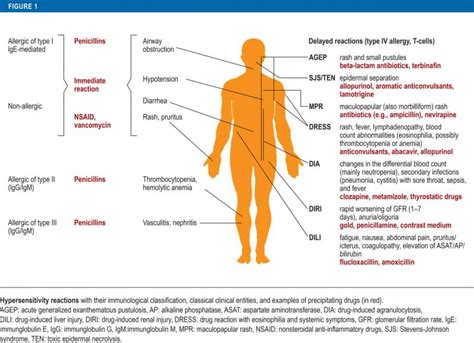 Drug Hypersensitivity Syndrome