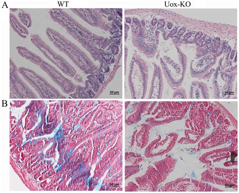 Impaired Intestinal Barrier Function In A Mouse Model Of Hyperuricemia