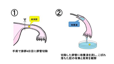 原因不明不妊の原因を調べるには？ よくあるご質問徐クリニック