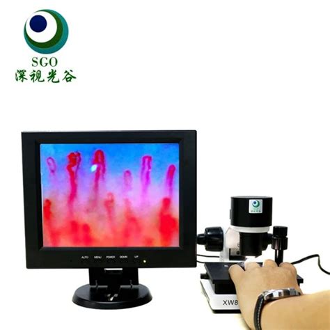 Detection Instrument Blood Capillary Microcirculation Microscope for ...