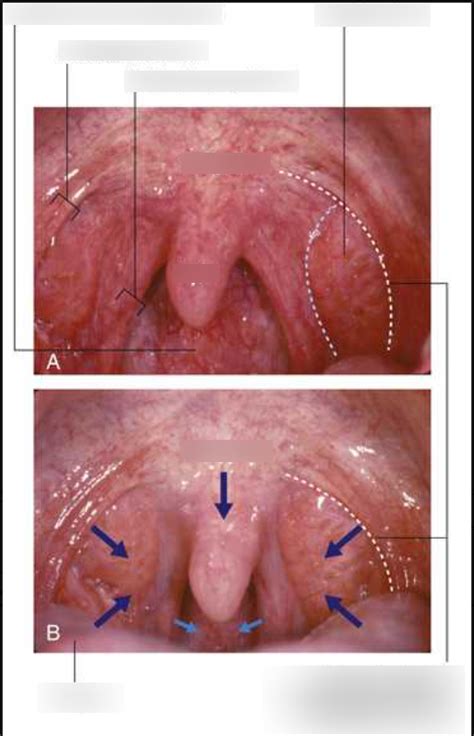 The Soft Palate Diagram Diagram Quizlet