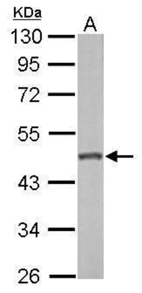 GALK2 Polyclonal Antibody Invitrogen 100 μL Unconjugated Antibodies