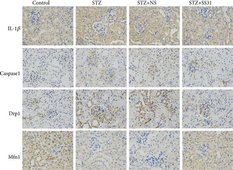 Renal Il 1β Caspase1 Mfn1 And Drp1 Expression In Diabetic Mice