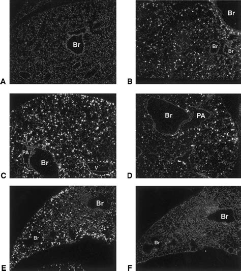 In Situ Hybridization Analysis For Transgene Expression In The Lung