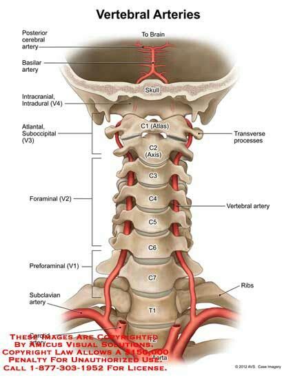 Vertebral Arteries Gross Anatomy Brain Anatomy Human Body Anatomy