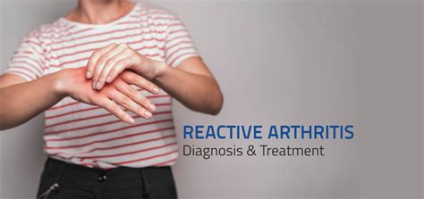 Symptoms And Treatment Of Reactive Arthritis Aster CMI Blogs