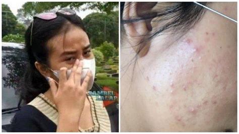 Mayang Klaim Wajah Rusak Usai Pakai Skincare Yang BA Nya Fadly Faisal