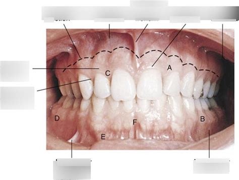 Gingiva Diagram | Quizlet