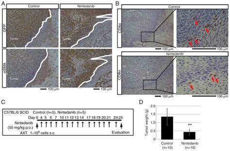 Singleagent Nintedanib Suppresses Metastatic Osteosarcoma Growth By