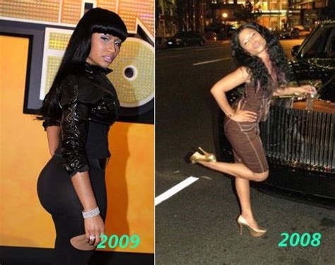 Plastic Surgery: Nicki Minaj before and after