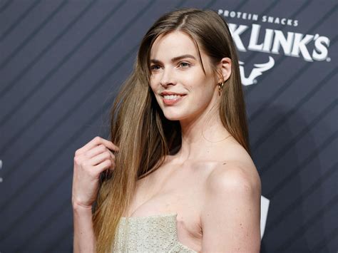 Model Robyn Lawley Shares Photos of Her Scars After Having a Seizure