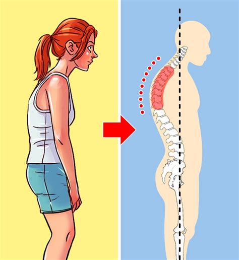 4 Types Of Poor Posture And How To Fix Each Of Them Bright Side