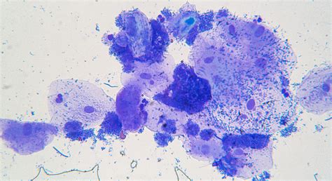 Parasites under the microscope | Academy of Nutritional Medicine