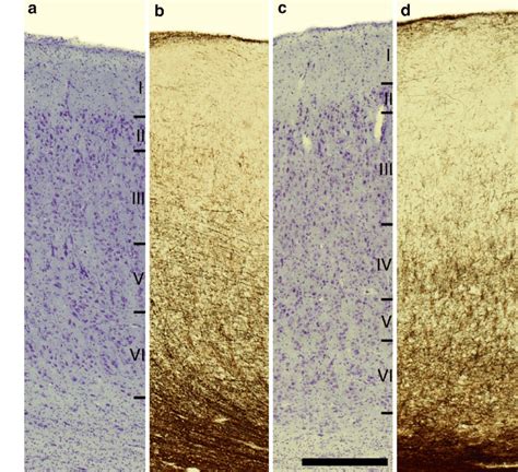 Photomicrographs Of Nissl A C And Myelin B D Stained Sections