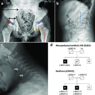 Patient S Summary A The Anteroposterior Radiograph Of Pelvis And Hips