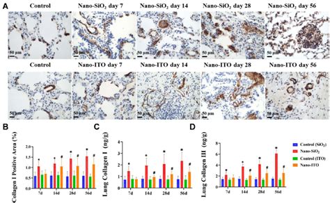 Expression And Levels Of Collagen Type I And Collagen Type III In Lung