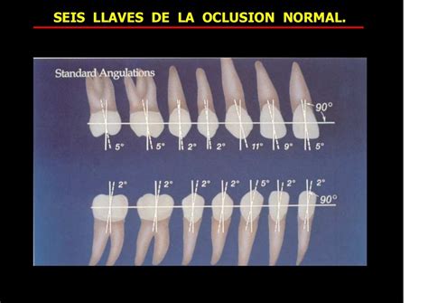 80518551 Seis Llaves De La Oclusion Normal 1 2015