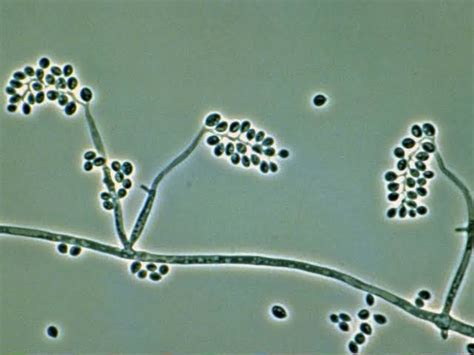 Beauveria Bassiana Bio Fungicide at Rs 1000/kg in Jaipur | ID: 21650325633