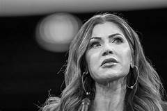 Kristi Noem Before And After Surgery