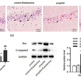 Esketamine Alleviates Propofol Induced Neuronal Injury A