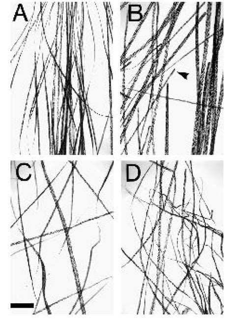 Hair Fiber Phenotypes Observed By Light Microscopy Comparison Of Hairs