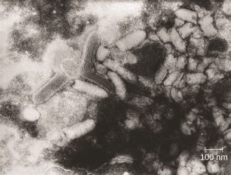 Acellular Diseases of the Nervous System · Microbiology