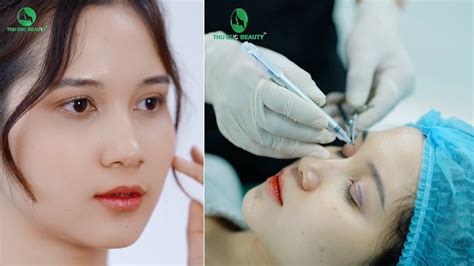 Hot Tiktoker Oanh Gấu sở hữu đôi mắt hút hồn sau Cắt mí TC YouTube