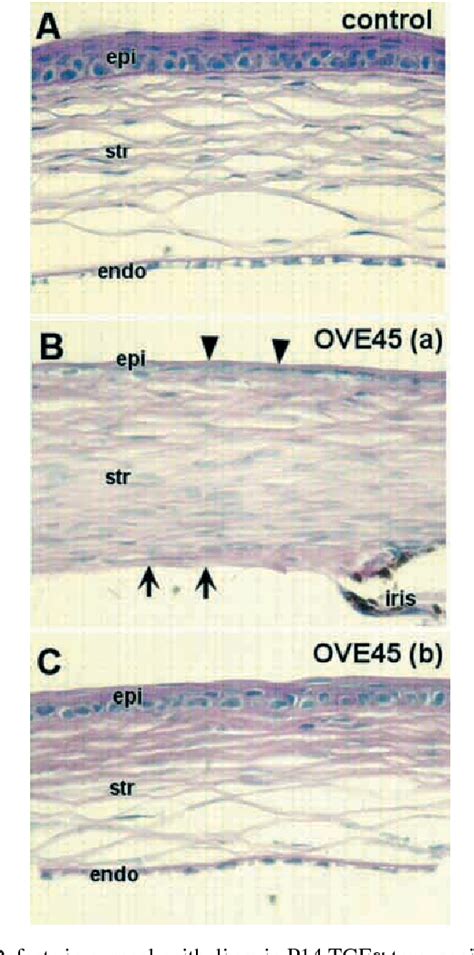 Figure 1 From Formation Of Corneal Endothelium Is Essential For