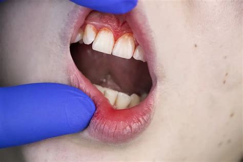 Six Reasons Why You Should See A Periodontist To Examine Your Gums