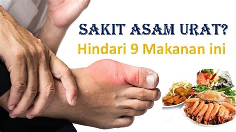 Inilah Jenis Makanan Yang Berbahaya Bagi Penderita Asam Urat Lapak