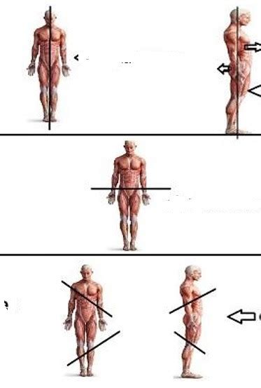 BODY PLANES AND SECTIONS Diagram | Quizlet